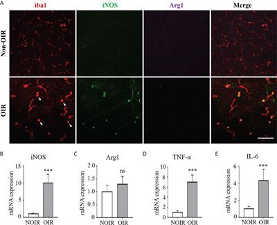 Ferulic acid alleviates retinal neovascularization by modulating microglia/macrophage polarization through the ROS/NF-κB axis